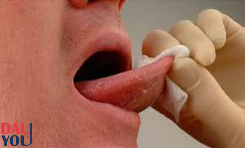 علاقة مرارة الفم و جرثومة المعدة