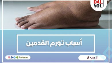 أسباب تورم القدمين