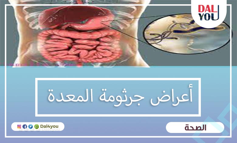 أعراض جرثومة المعدة القوية