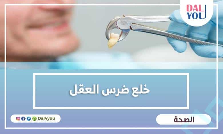 خلع ضرس العقل