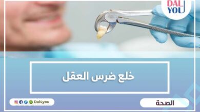 خلع ضرس العقل