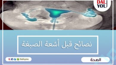 نصائح قبل أشعة الصبغة