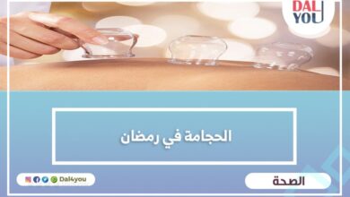 الحجامة في رمضان